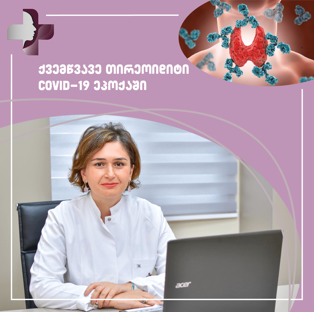 ქვემწვავე თირეოიდიტი COVID-19 ეპოქაში