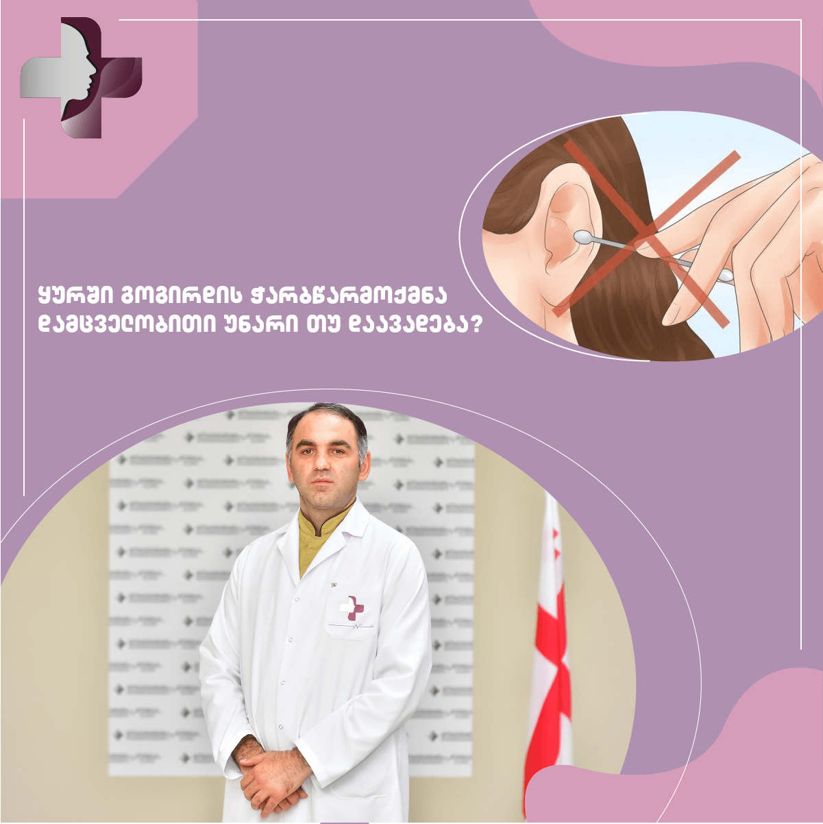 ყურში გოგირდის ჭარბწარმოქმნა