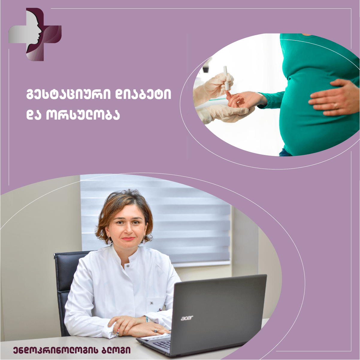 გესტაციური დიაბეტი და ორსულობა